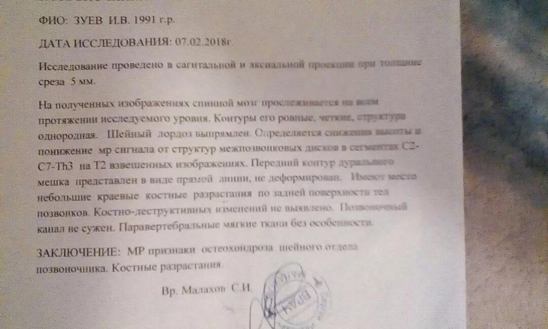 Узи сосудов головного мозга и шеи. Узи брахиоцефальных артерий. Узи шеи. Мрт головного мозга и сосудов описание. Что лучше мрт или узи сосудов шеи.