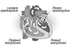 Сколько живут с кардиостимулятором. Проводящая система сердца. Кардиоресинхронизирующая терапия. Кардиоресинхронизирующее устройство.