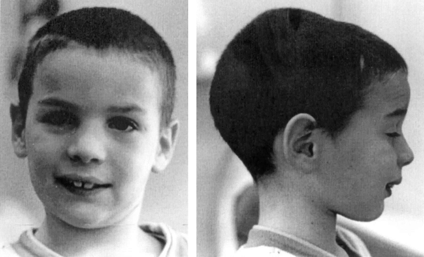 Ребёнок расшиб губу об качель. Ломание голоса у мальчиков. Дети с ломкой. Фото задумчивого ребенка. Дети с ломкой.