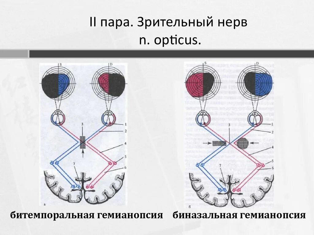 Зрительный нерв (II пара, 2 пара, вторая пара черепных нервов), n. Opticus. 2 Пара ЧМН зрительный нерв. Зрительный нерв 2 пара анатомия. Зрительный нерв 2 пара черепных нервов. Два зрительных нерва