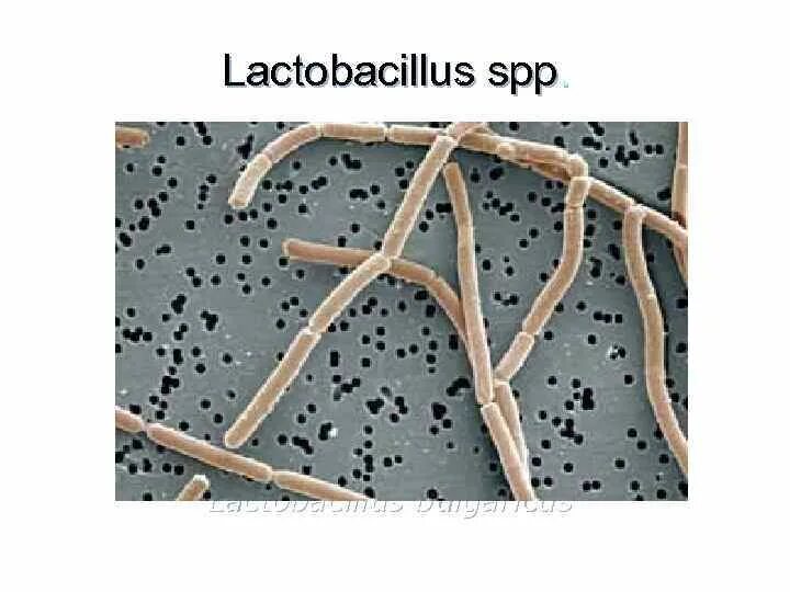 Lactobacillus SP. Лактобацилус SPP. Lactobacillus SPP фото. Lactobacillus SPP микрофото.