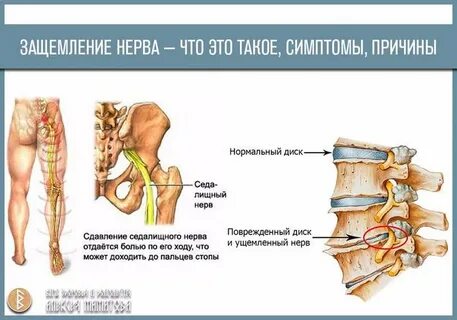 Защемление в частном доме. Крепление провода к заземлителю. Защемление в частном доме. Защемление в частном доме. Линейный контур заземления схема.