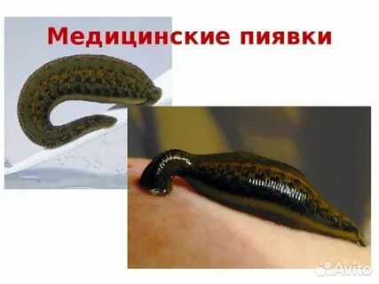 Медицинские пиявки краснодар