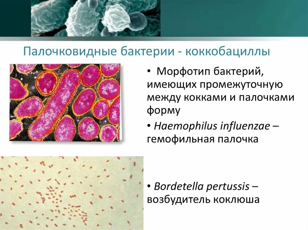 Haemophilus в мазке у мужчин. Палочковидными (бациллы, клостридии). Палочки и кокки микроскопия. Кокки палочковидные и бациллы.