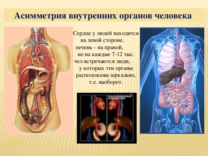 Какие органы у человека с левой. Внутренние органы сердце. Асимметрия внутренних органов человека. Зеркальное расположение органов. Расположение органов сердца.