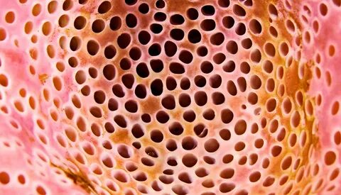 Body hole