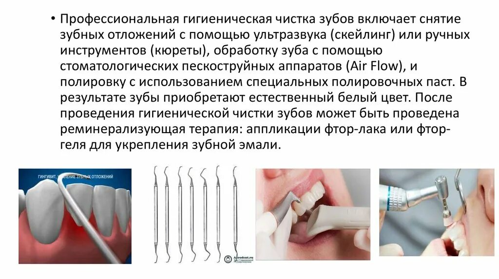 После чистки зубов можно ли пить чай. Методы снятия зубных отложений. Инструменты для выявления зубных отложений. Зубные отложения инструменты. Ручные инструменты для снятия зубных отложений.