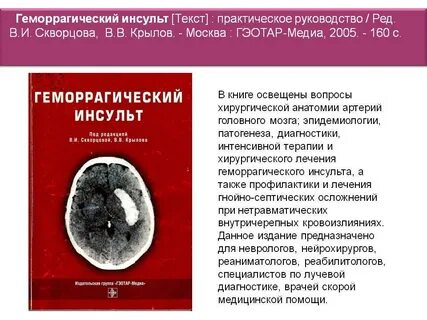 Оформление инвалидности после инсульта