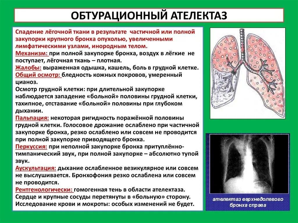 Причины изменений в легких. Синдром ателектаза легкого компрессионный. Симптомы обтурационного ателектаза. Синдром ателектаза симптомы. Синдромы компрессионного и обтурационного ателектаза легких.