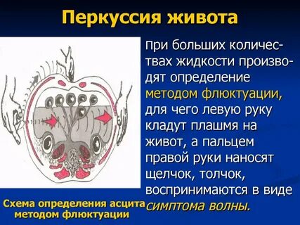 Перкуссия живота