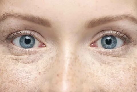 Does your eyes blue