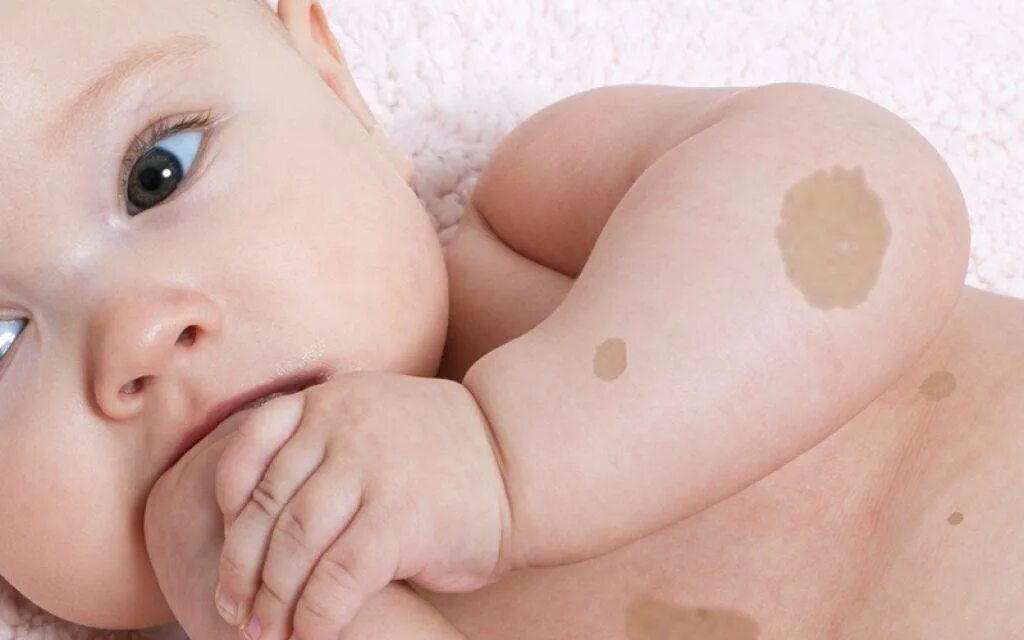 У новорожденного появились. Новорожденный ребенок. Лануго у новорожденных волосы. Новорожденный плачет. Грудной ребенок.