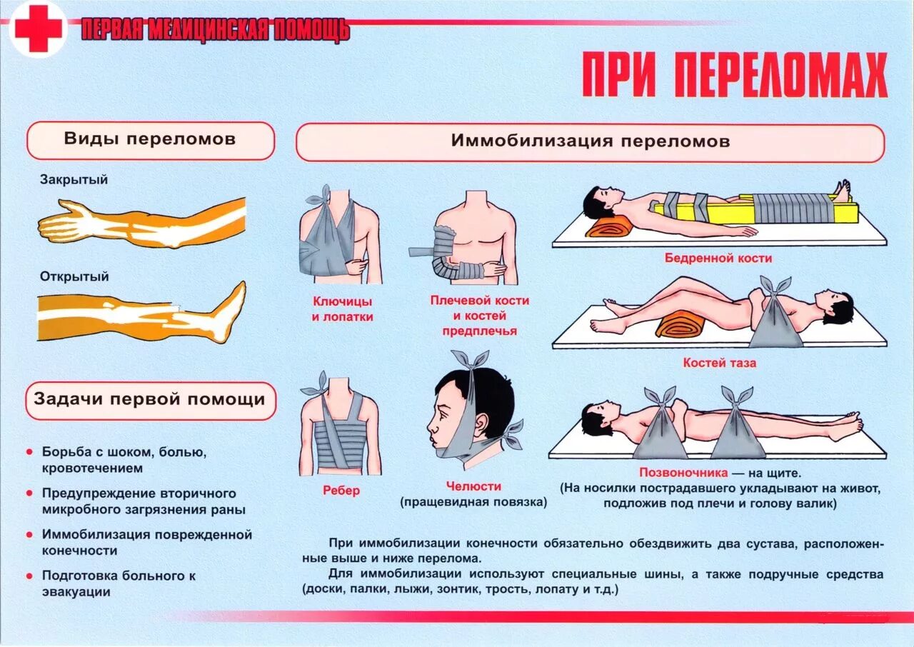 При открытых переломах в первую очередь. Алгоритм оказания первой помощи переломы конечностей. Перелом и оказание первой медицинской помощи при переломе. Оказание первой медицинской помощи при ранениях и закрытых травмах. Порядок первой мед помощи при переломе.