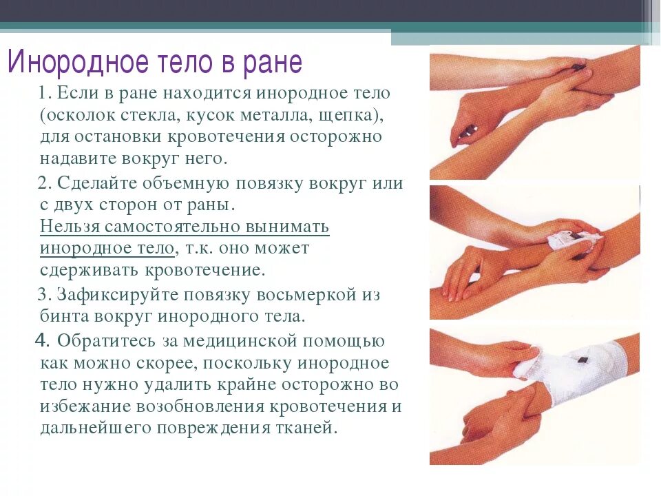 Сильная рана что делать. Оказание первой помощи при ранах. Оказание первой помощи при ранении руки. Оказание первой помощи при ранениях и кровотечениях.