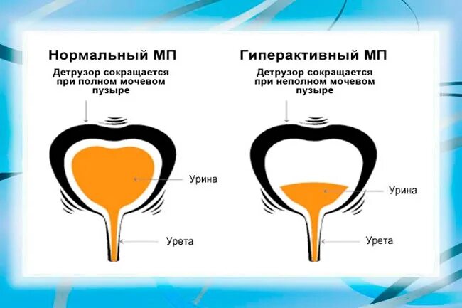 Мочевой пузырь у мужчины форум