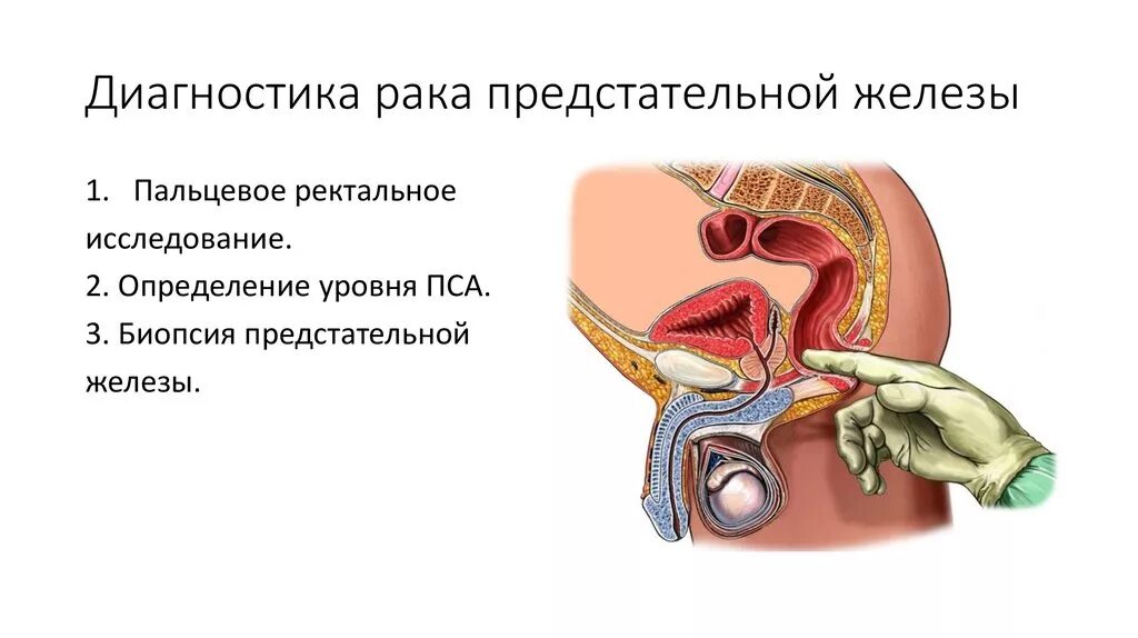 Простата кишечника