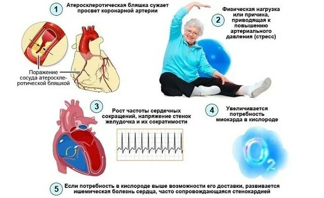 Долго колит сердце. Долго колит сердце. Что делать потсердечном приступе. Побаливает сердце. Боли в сердце причины.