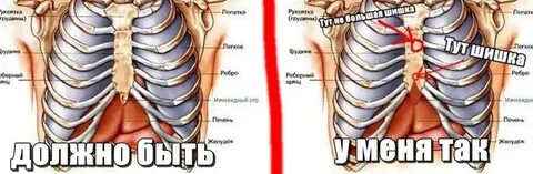 Боли в грудной клетки у мужчин