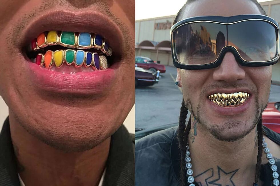 ⚠ ️WHEN U REPIN GIVE CRED PiNtErEsT:@bbgxloni Grillz, Gold grillz, Gold teeth gri
