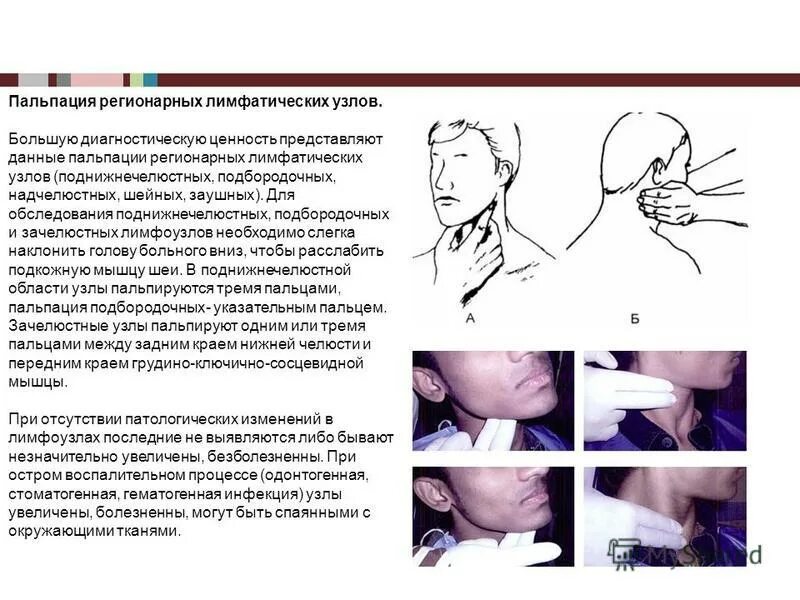 Как правильно лимфоузел. Алгоритм пальпации шейных лимфоузлов. Методика пальпации периферических лимфатических узлов. Пальпация периферических лимфатических узлов алгоритм. Пальпация лимфоузлов алгоритм.