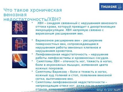 Недостаточность венозного клапана