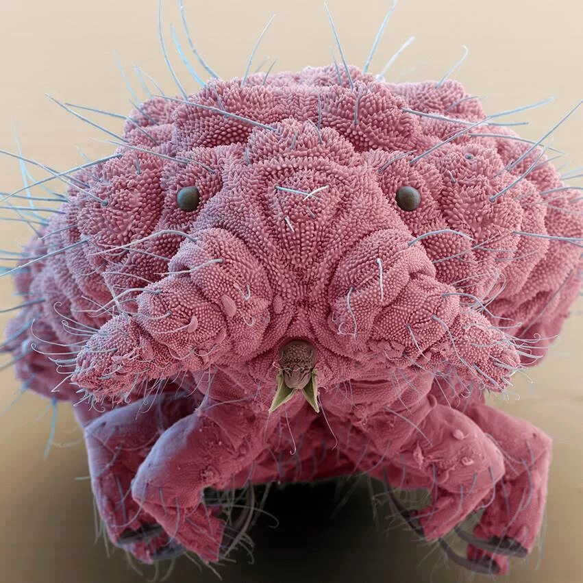 Как выглядят микробы. Springtail (bilobella sp.. микробы под микроскскопом. бакетриипод микроскопом. бактерии под микроскопом.