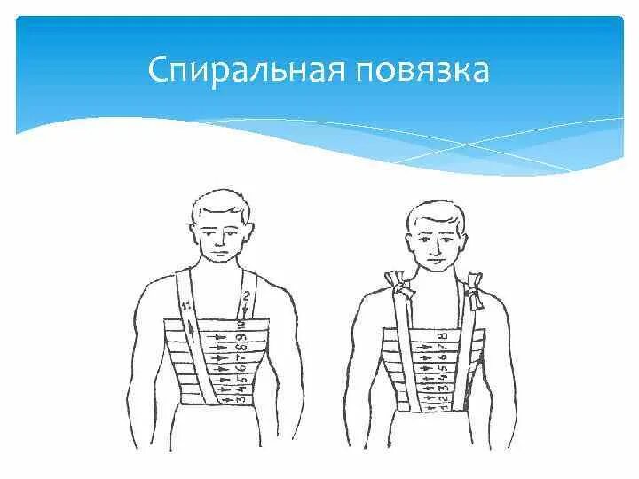 Спиральная повязка техника наложения
