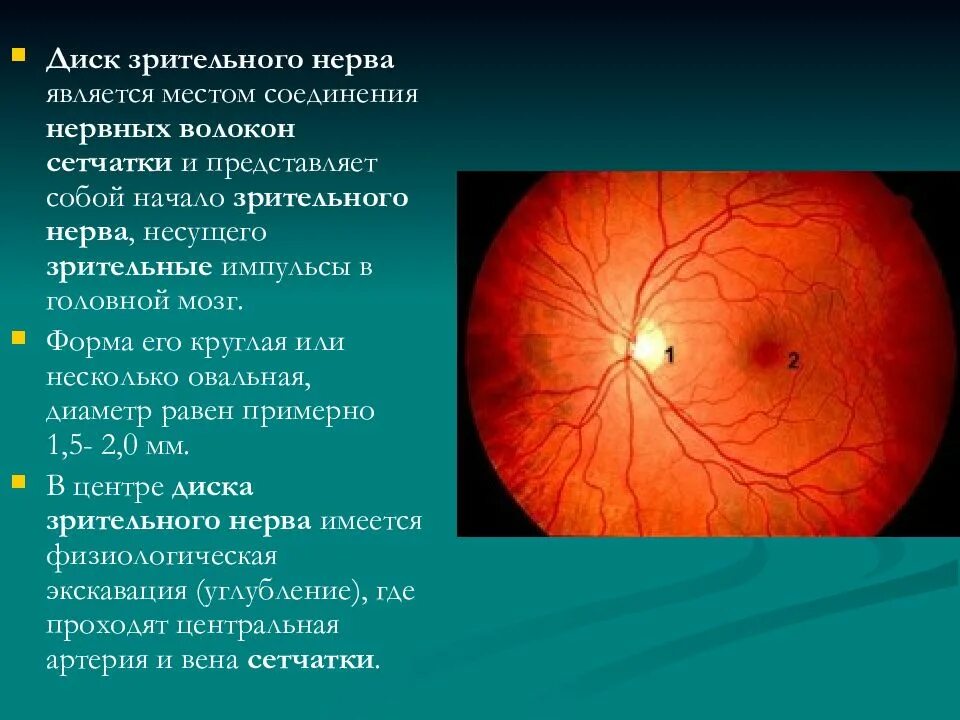 Атрофия зрительного нерва у детей. Краевая экскавация диска зрительного нерва. Диск зрительного нерва в норме. Диск зрительного нерва анатомия.