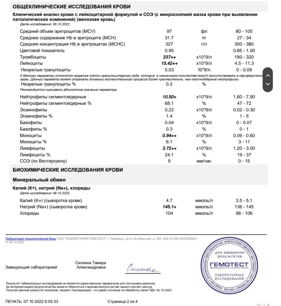 Результаты анализов при тромбозе. Печать для анализов февраль. Пересвет Результаты анализов. Результат анализов на бумажную пыль.