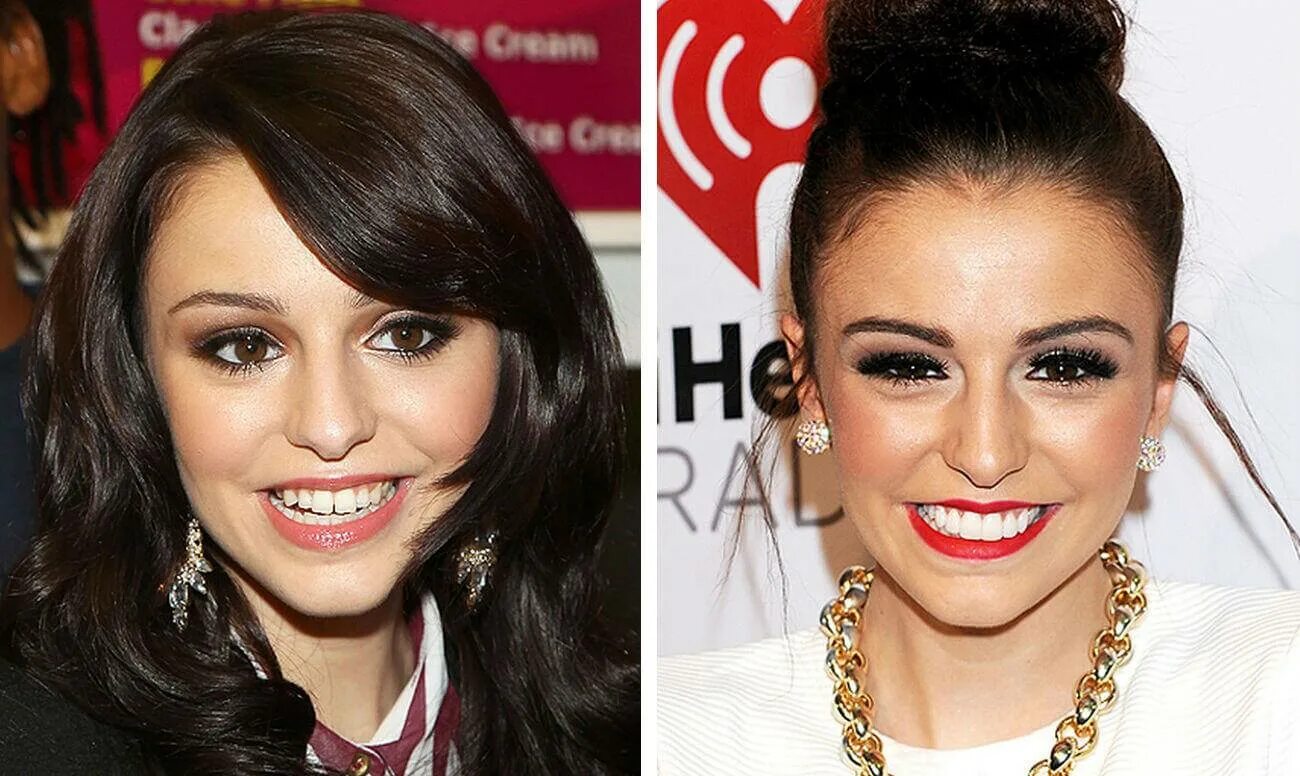 Зубы звезд майли сайрус. Юлия ахмедова виниры. Майли сайрус зубы брекеты. Улыбки знаменитостей до и после. Шерил коул зубы до и после.