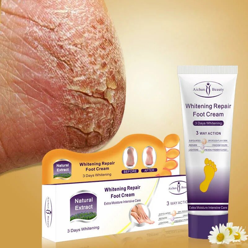 Крем для ног от трещин Aichun Beauty, 100мл. Moisturizing foot Care Cream 100g. Крем для ног Aichun Beauty Whitening Repair foot Cream, 100g. Крем для пяточек против трещин. Трещина на пятке лечение отзывы