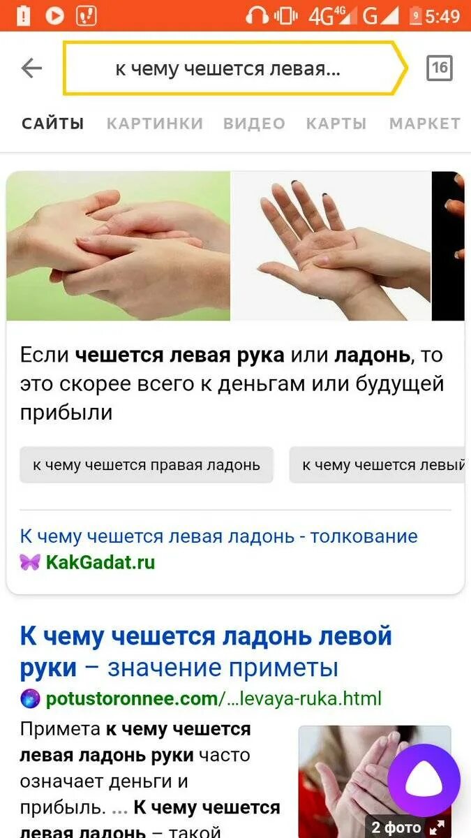 Что означает если чешется рука. К ярму чешебмч левач рука. к сему чешется левая броко. к чему чешется правая ладонь. зачесалось запястье левой руки примета.