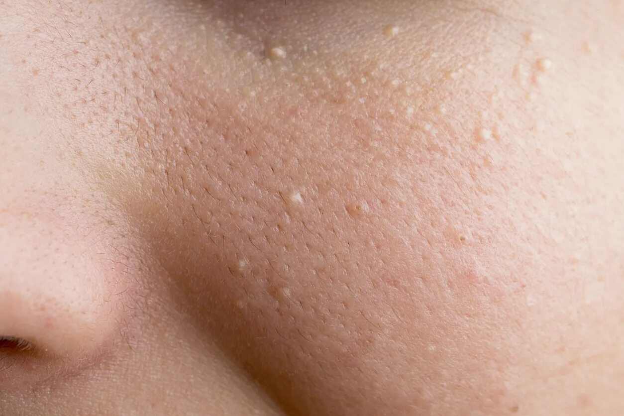 черные точки у ребенка 10 лет