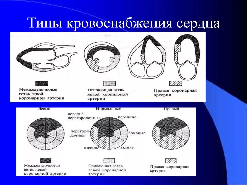 Локальная сократимость левого желудочка. Типы коронарного кровотока. Типы кровоснабжения сердца. Кровоснабжение миокарда схема. Тир коронарного кровоснабжени.