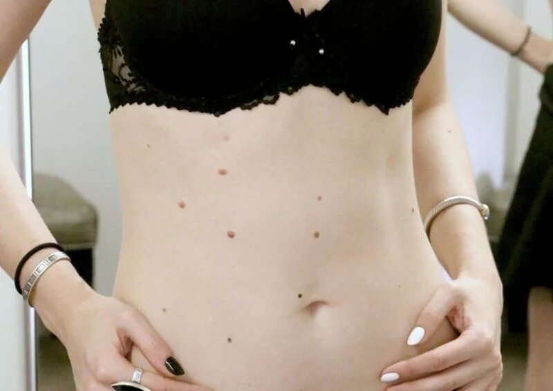 Красивая спина с родинками. Родинка на теле женщины. Родинка на теле женщины. Родинка на теле женщины. Родинка на теле женщины.