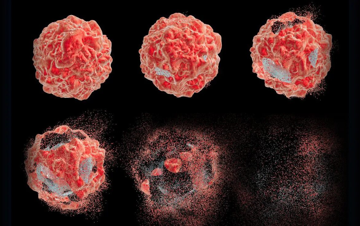 Апоптоз раковых клеток. Апоптоз злокачественных клеток. Апоптоз микрофотография. Гибель клетки апоптоз. Как уменьшить опухоль