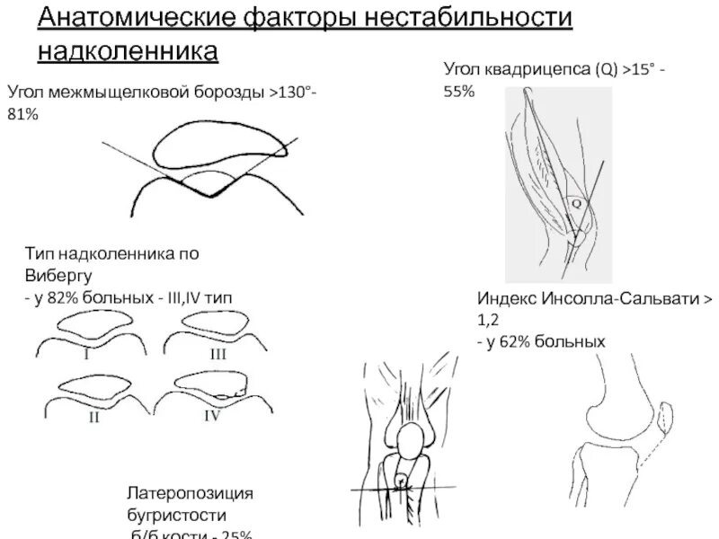 Латерализация надколенника. Надколенник 2 типа по Wiberg что это. Типы надколенника по Wiberg. Надколенник II типа по Wiberg. Латеропозиция надколенника.