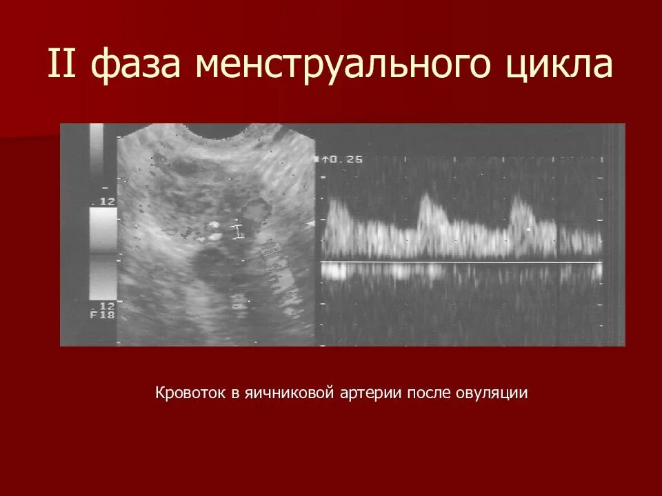 Вторая фаза менструационного. Вторая фаза менструального цикла. Фазы менструационного цикла 2 фаза. 2 Фаза цикла что это значит. УЗИ 2 фазы менструационного цикла.