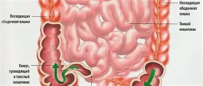Строение кишечника в животе. Кишечник форум врачей