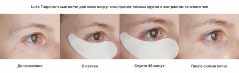 После патчи надо смывать