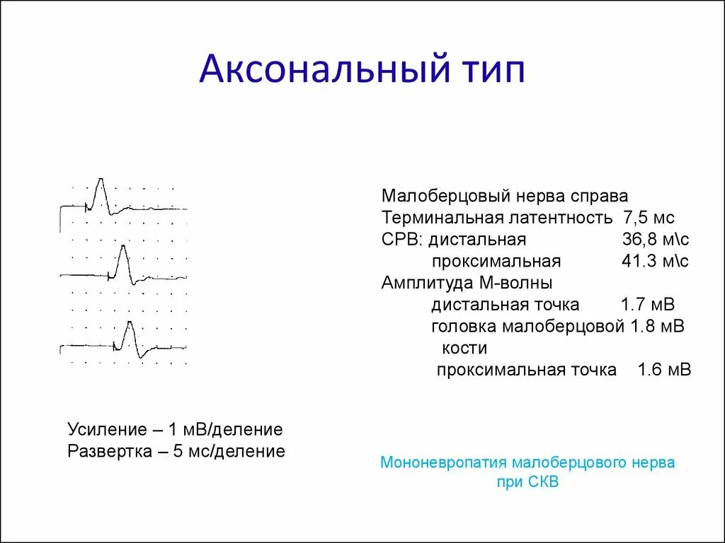 Аксональный Тип. Дистальная латентность что это. Резидуальная латентность показатели ЭНМГ. Аксональное поражение малоберцового нерва что это. Типы поражения нервов