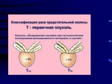 Предстательная железа презентация
