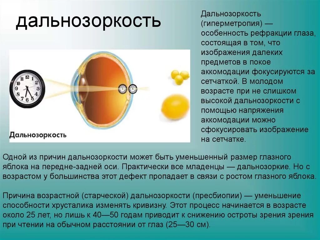 Зрение 10 что значит. Миопия дальнозоркость астигматизм. Гиперметропия высокой степени рефракция. Дальнозоркость (гиперметропия). Заболевание дальнозоркость.