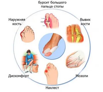 Психосоматика пальцев ног