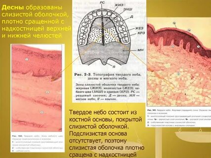 Слизистая оболочка десны