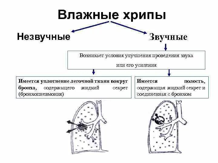 Звонкие хрипы. Патогенез влажных хрипов. Схема возникновения хрипов. Механизм возникновения влажных хрипов. Звучные влажные хрипы.