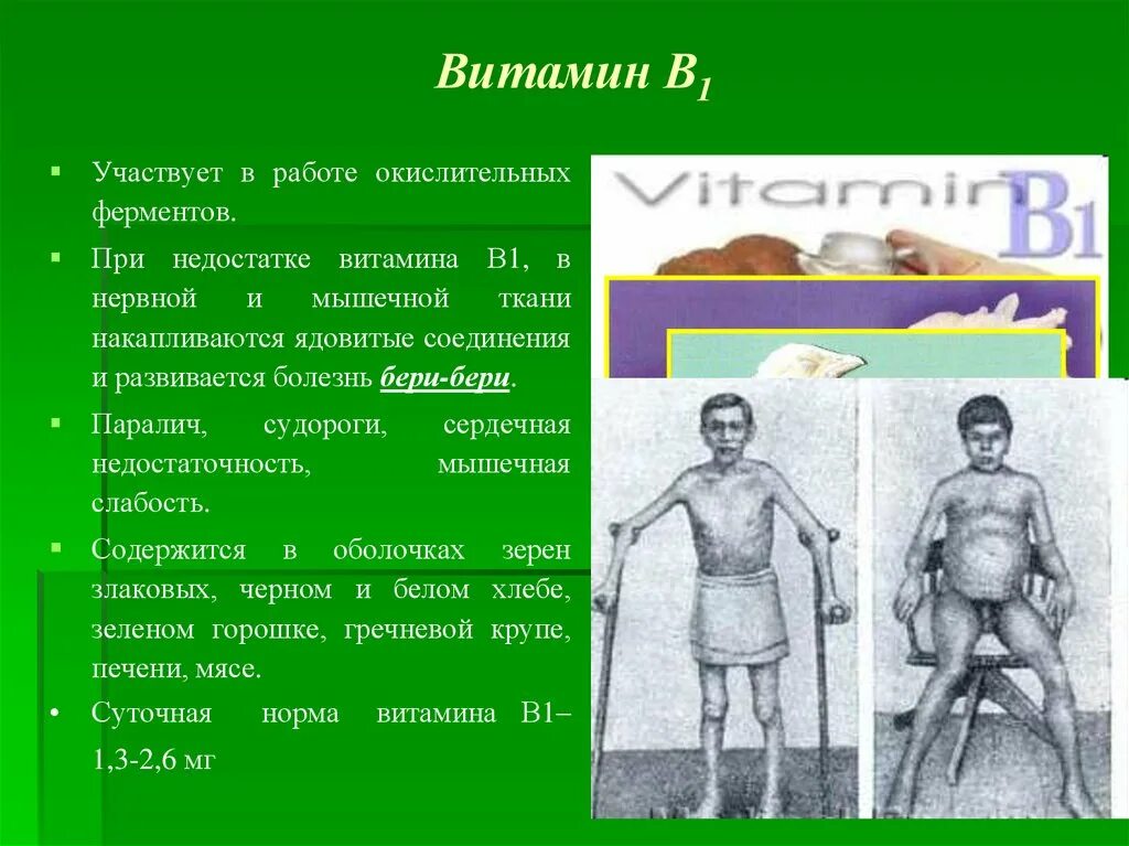 Витамин б бери бери. Признаки недостатка витамина b1. Дефицит витамина b1 симптомы.