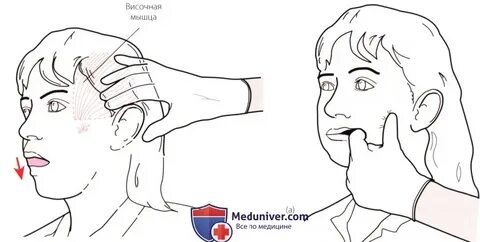 Определите функцию височных мышц приложите руки