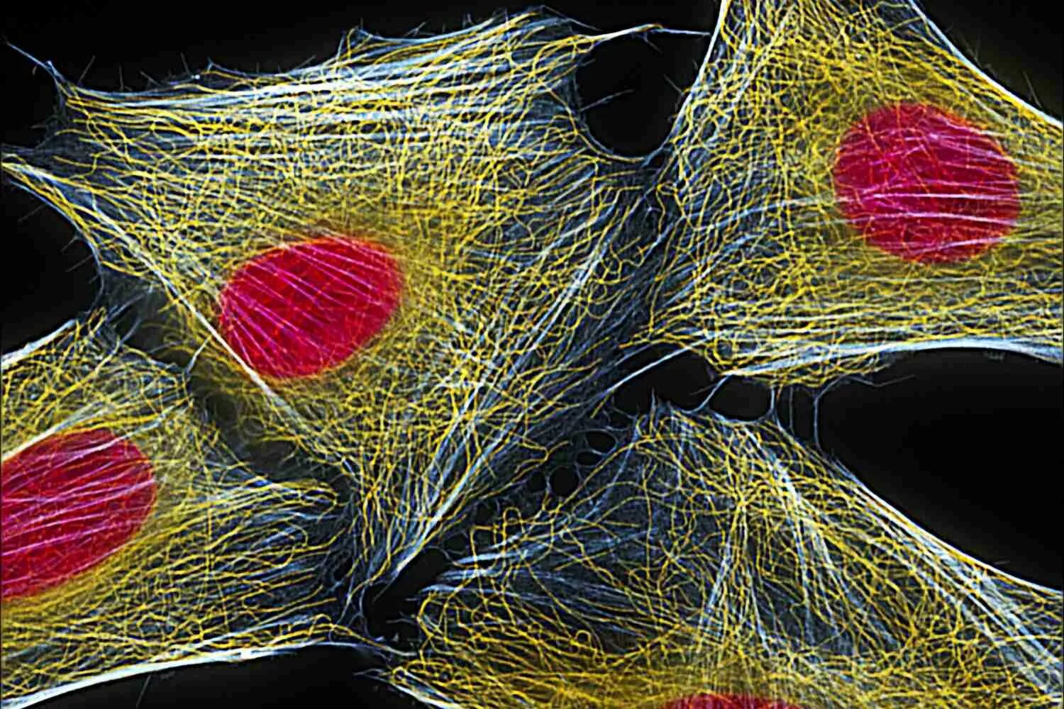 Сильно вытянутые клетки. Цитоскелет клетки микрофотография. Микрофотография цитоскелета. Цитоскелет микроскоп. Цитоскелет клетки человека.