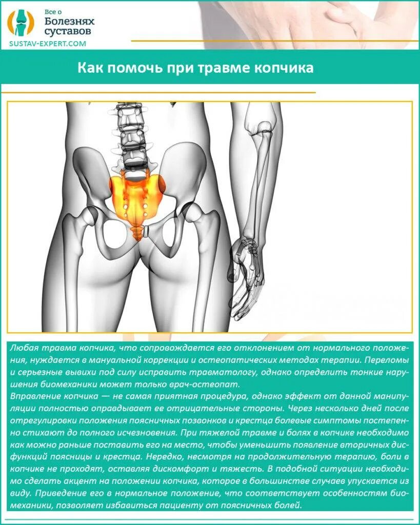 Болит спина у копчика. Боль в области крестца и копчика. Брои в крестцовой области.